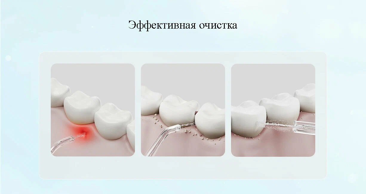 Ирригатор Xiaomi Mijia Electric Teeth Flosser F300 Smoked, зеленый (MEO703) в Челябинске купить по недорогим ценам с доставкой